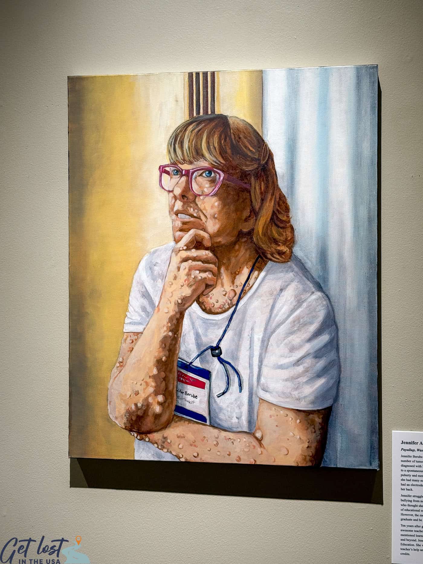 neurofibromatosis exhibit at Blanden Memorial Art Museum.